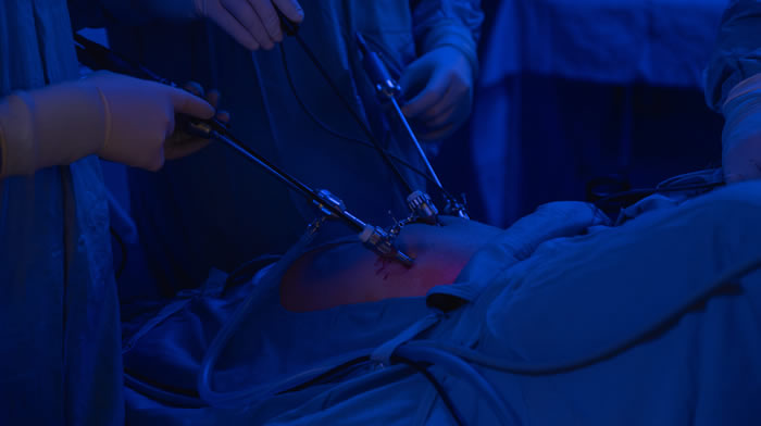https://malzonicenter.com/wp-content/uploads/2025/02/img-patologia-laparoscopia.jpg